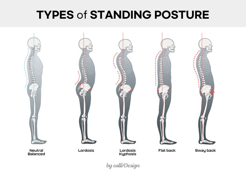 (광교중앙역 진심과성한의원) 잘못된 자세와 통증의 연관성. 곧은 목, 곧은 허리, 평평한 등이 더 아픈 이유는 무엇입니까?