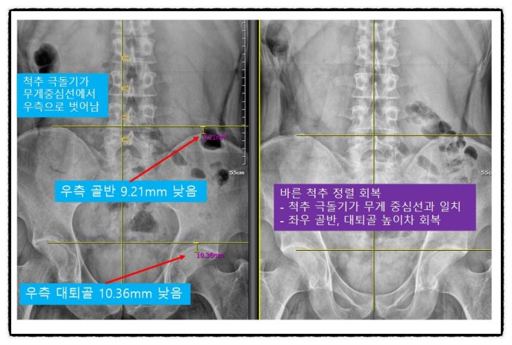  광주남구정형외과, 방문 전 3가지만 확인하세요