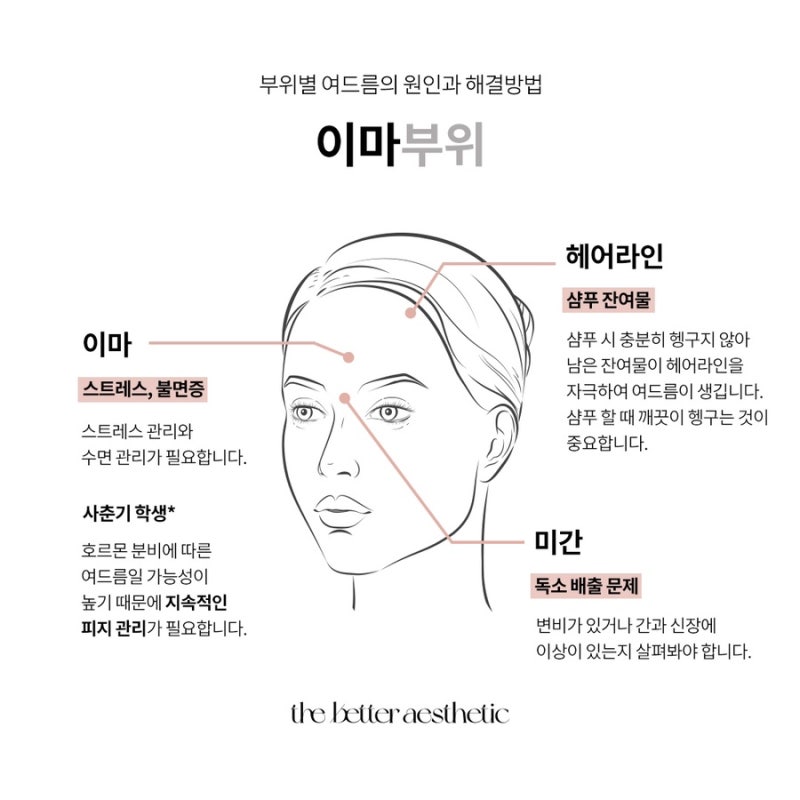 여드름 부위별 원인과 치료법 6