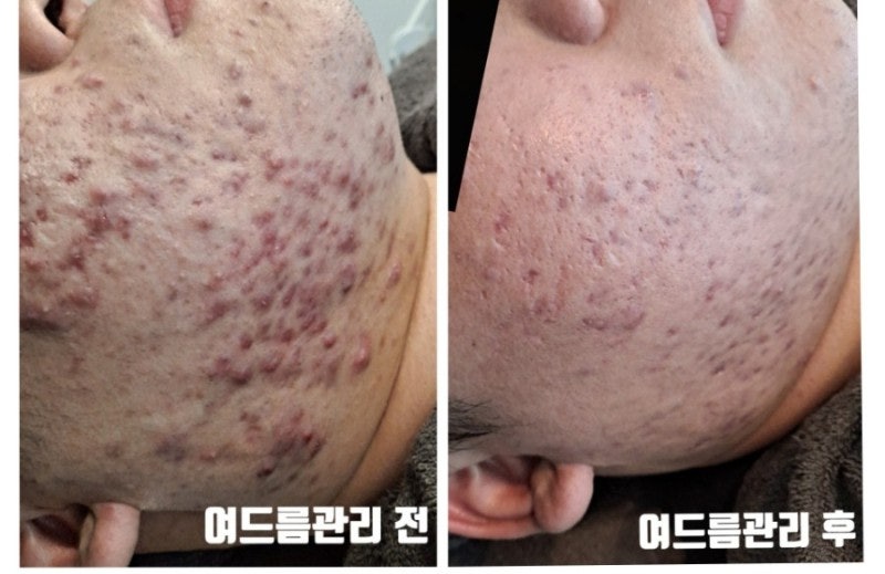증평피부과 이 3가지 잘하는 곳은?