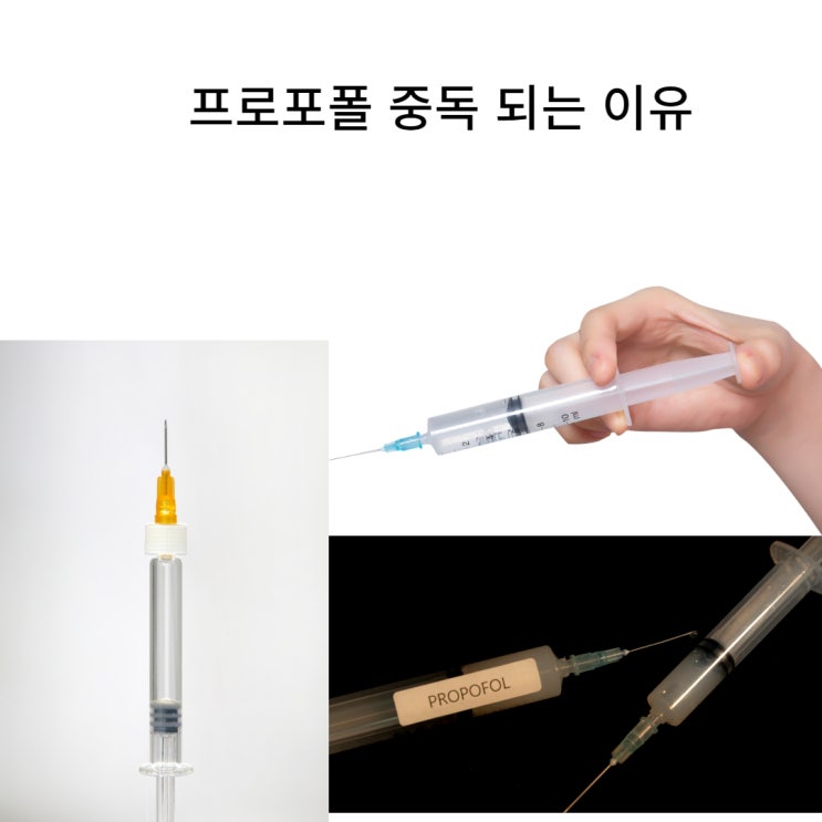 <b>유아인</b> <b>프로포폴</b> <b>프로포폴</b> 중독되는 이유 부작용 주의사항