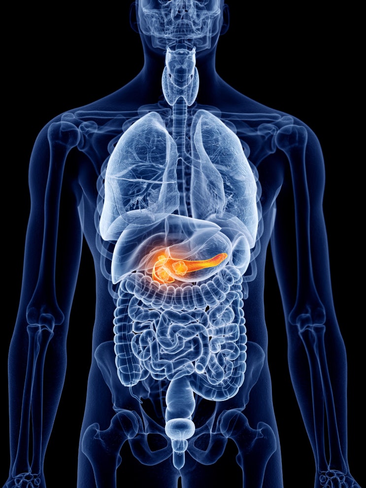 급성 췌장염 원인과 증상 예방법 이야기
