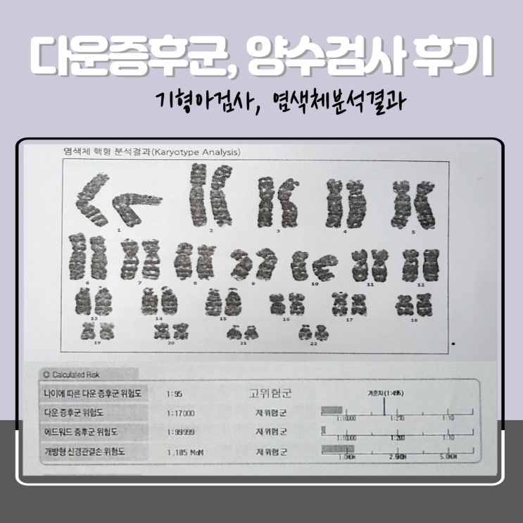  [임신일기] 기형아검사 다운증후군 고위험군｜니프티가 아닌 양수검사를 진행한 후기