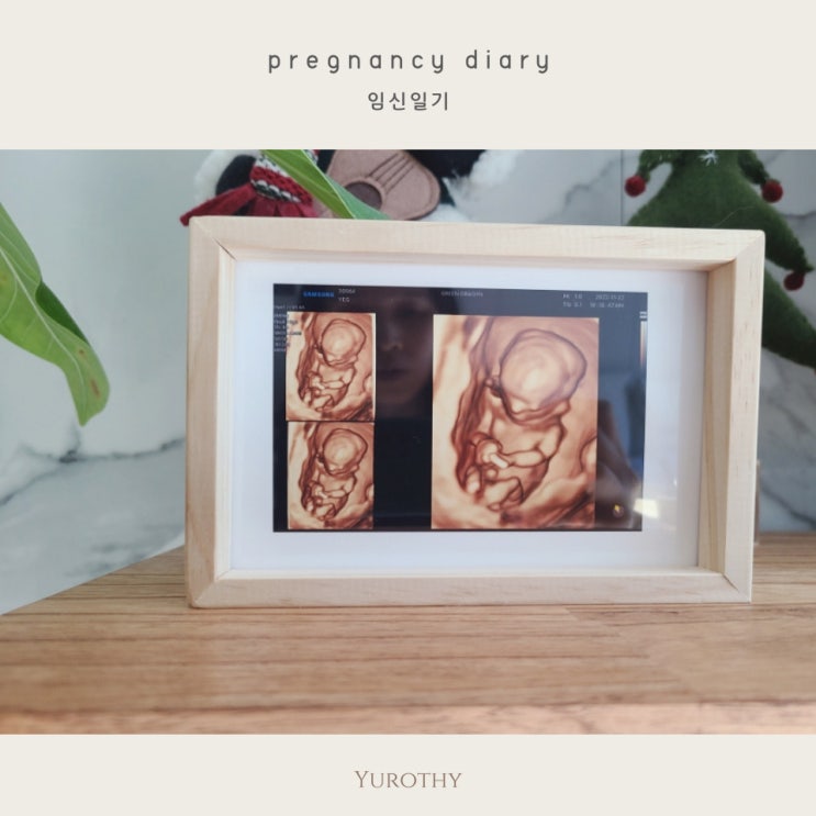[임신일기] 12주~20주 기록｜신기했던 입체초음파, 걱정많았던 기형아검사와 목투명대두께
