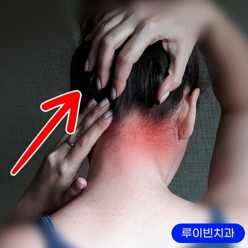 뒷머리찌릿 귀뒤통증(왼쪽 오른쪽) 아플때 : 네이버 블로그 뒷머리찌릿 귀뒤통증(왼쪽 오른쪽) 아플때 : 네이버 블로그