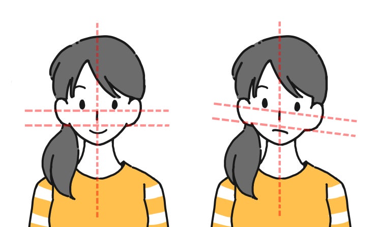  37년 경력 고민정 원장의 얼굴 좌우 비대칭 3가지 노하우