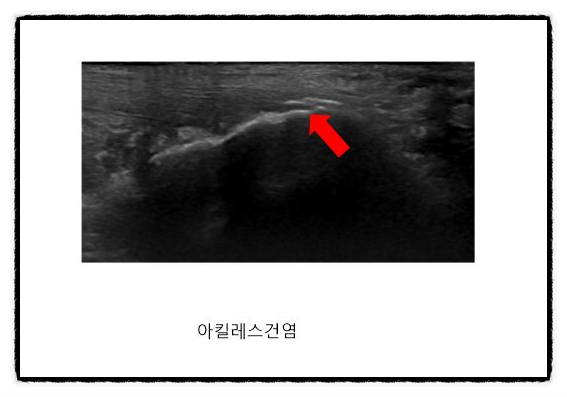  광주신경외과, 서울에서 찾아오는 이유? (feat.Dr Lee)