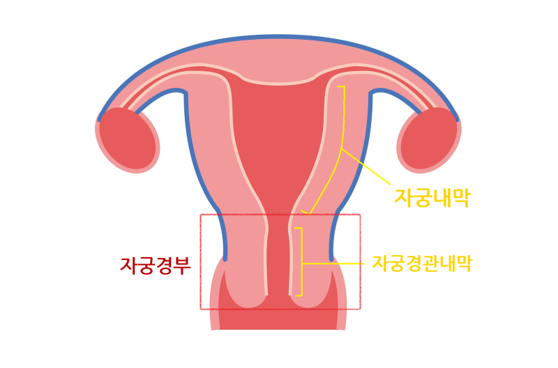 자궁경부암 검사에서 "비정형 선세포 (AGC)"가 나왔을 때