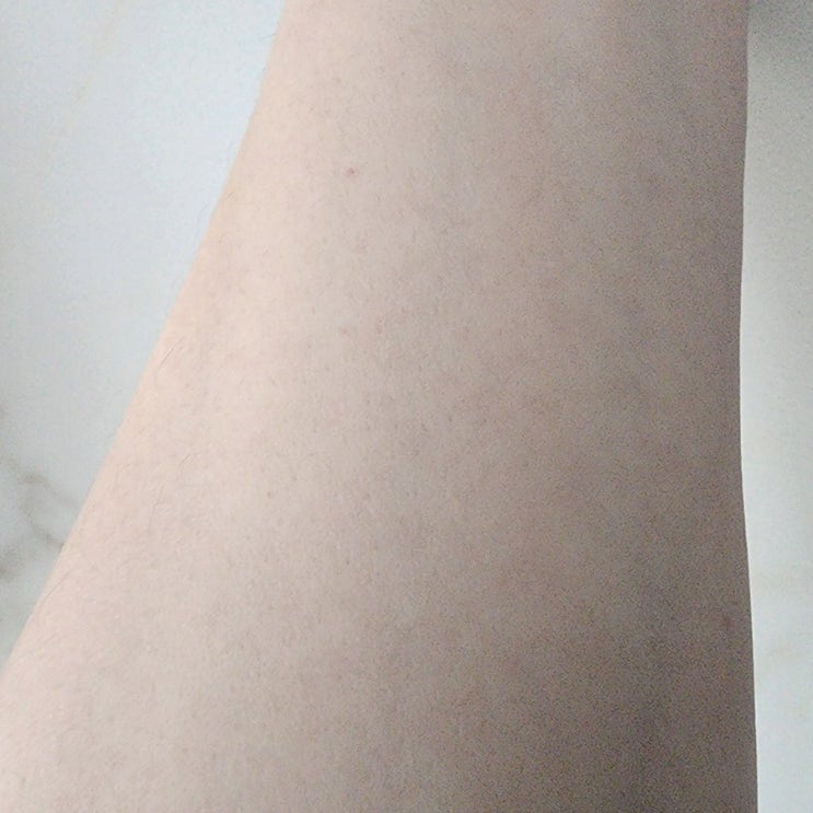  얼굴 실핏줄 터짐 원인 예방할 수 있을까