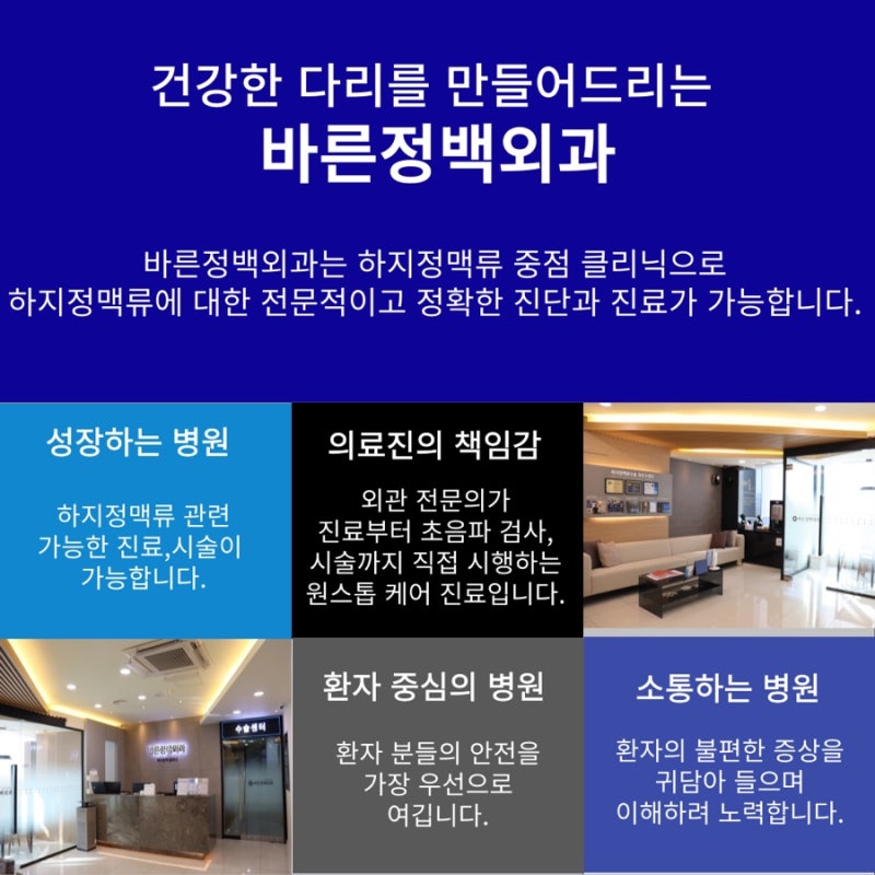 울산하지정맥류 케어 방법과 2