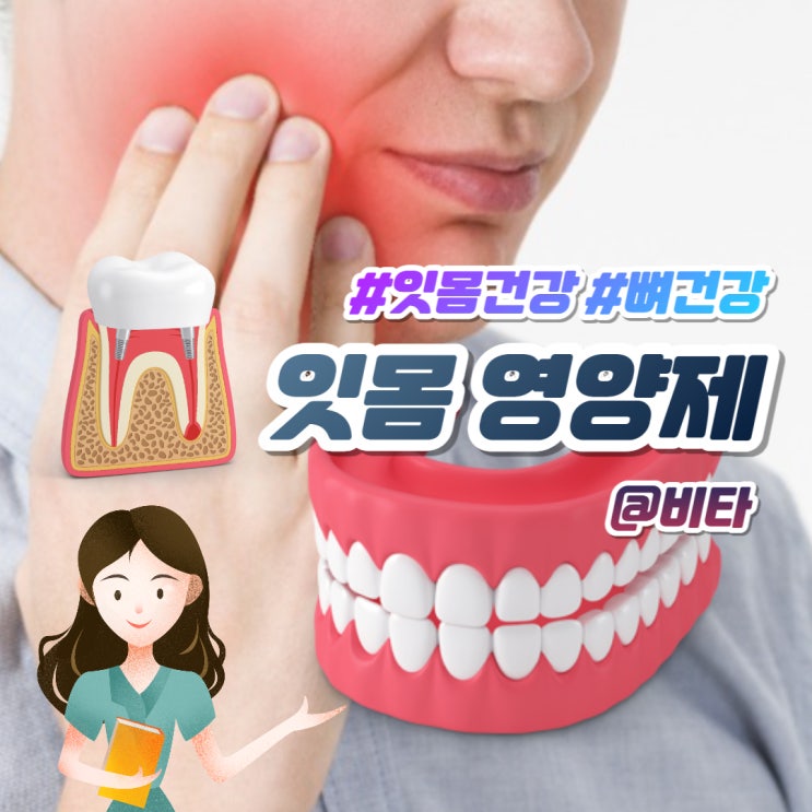  잇몸영양제 내려앉음 부었을 때, 레시피더블유