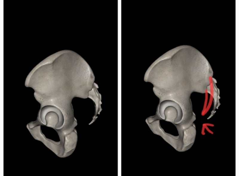 몸의 불균형 원인을 찾아라 (5) - 두 개의 깊은 엉덩이. 모래시계 모양.흉부 전만증