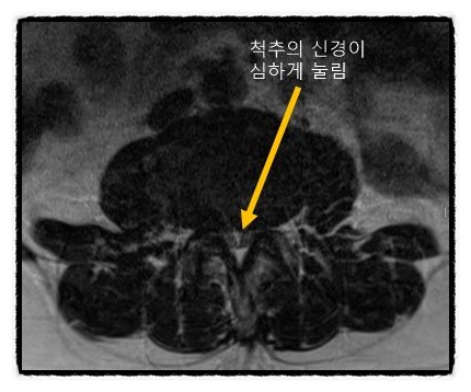  광주재활의학과, 의사가 말하는 병원 고르는 꿀팁