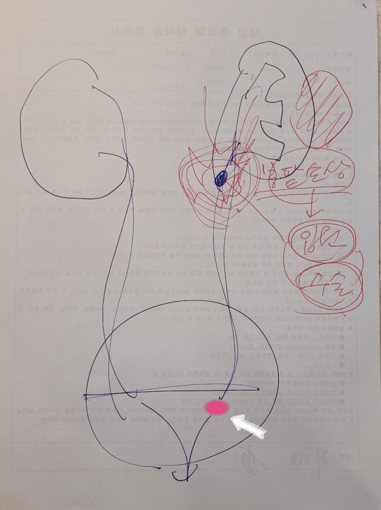  일요일 아침 응급실 요로결석 치료 물 많이 안드신다고 합니다.