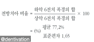  내 위아래 앞니 크기는 조화로울까? 볼튼 비율(Bolton Ratio) 계산법과 의미 알아보기