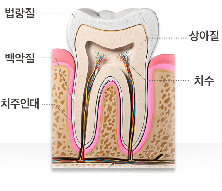 보험 충치치료 태평역치과 서울좋은치과 – 초기 충치는 모두 치료해야 할까요?