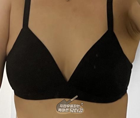  가슴필러 고민된다면? 가슴골의 중요성!