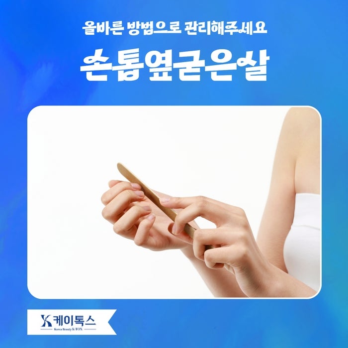 손톱옆굳은살 올바른 방법으로 관리해주세요