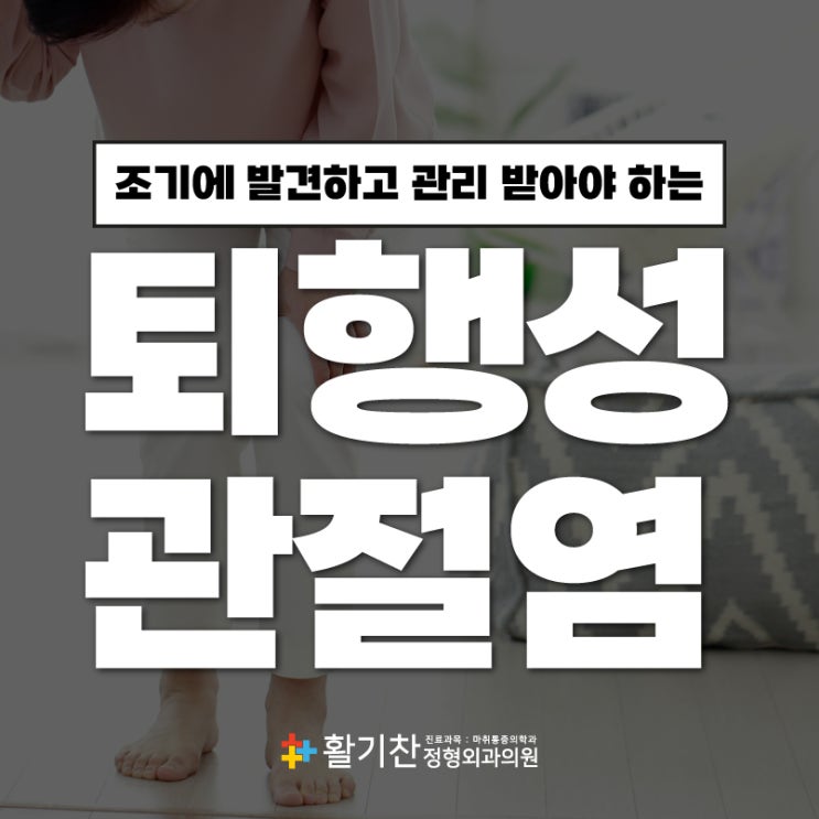  연신내무릎통증 운동할 때마다 아픈 퇴행성관절염
