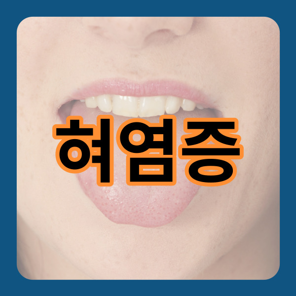  혀염증 이대로 괜찮을까요?