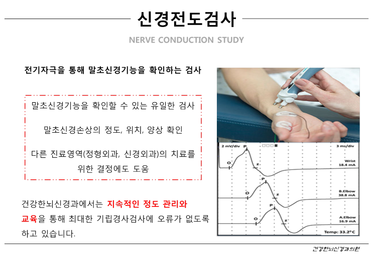 말초신경기능을 확인하는 유일한 검사: 신경전도검사와 근전도검사