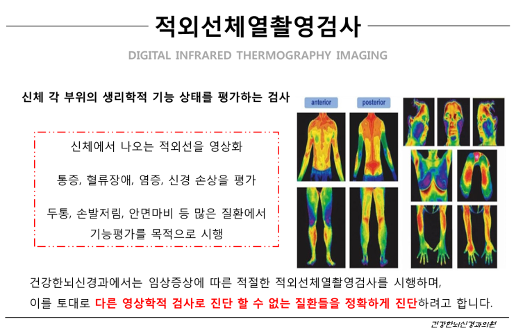  통증을 보는 눈. 적외선체열촬영검사