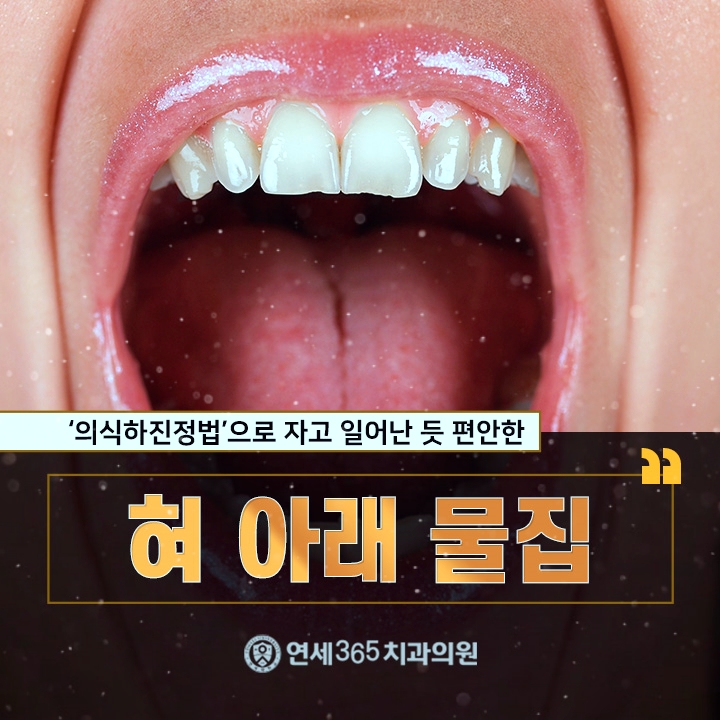  혀아래물집 생활에 불편함을 일으키기에