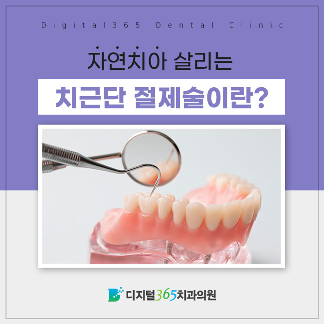  자연치아의 중요성과 치근단 절제술