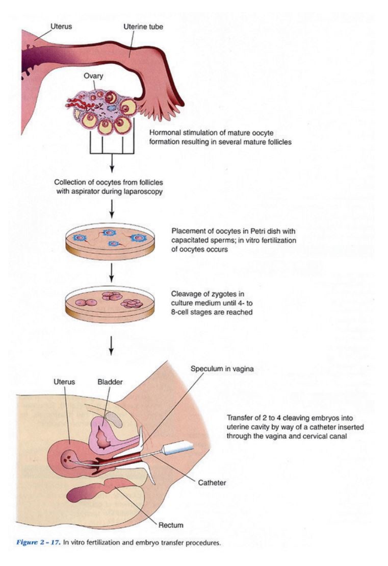 나의 태초 시작 돌아보기 : 네이버 블로그, image size:761x1109