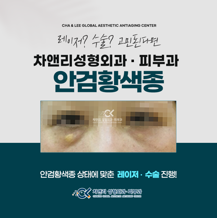  안검황색종 수술 흉터, 재발 걱정된다면