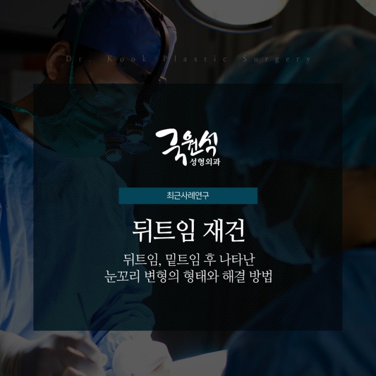 뒤트임 + 밑트임 후 나타난 눈꼬리 변형