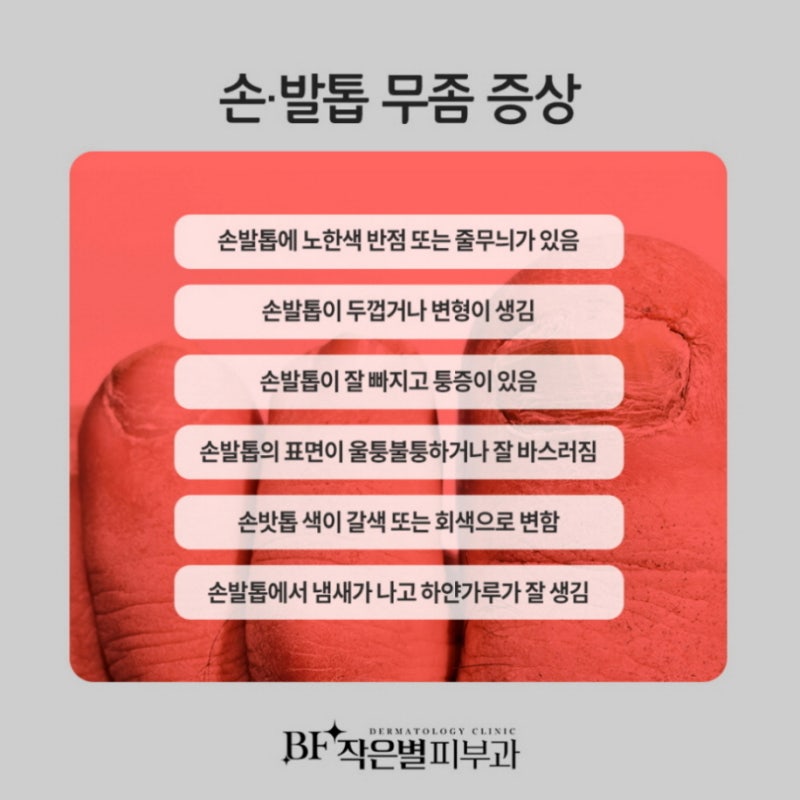 여의도손톱무좀피부과_레이저치료로 깨끗하게 (실비보험 적용)