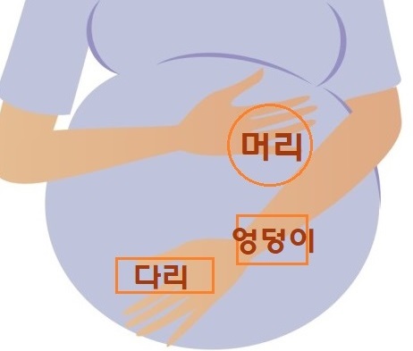  임신 29주 30주 증상, 초음파/양수 정상수치/태아 역아(둔위)/역아 돌리는 자세_오류동 삼성미래여성병원
