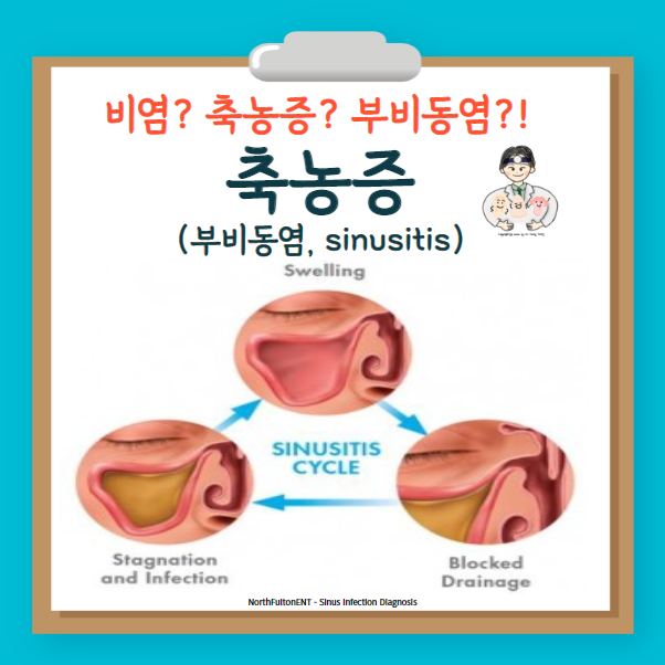  축농증(부비동염, sinusitis) (1) - 용어, 발생 기전, 분류