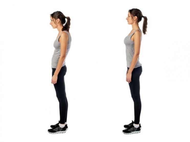  부산 자신없어 보이고 복부비만 유발하는 라운드숄더(round shoulder)