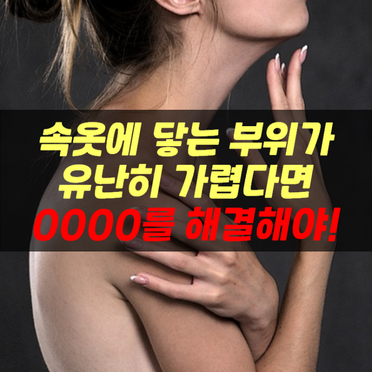  가슴부위 아토피와 습진, 속옷에 닿는 부위가 유난히 가렵다면 '이것' 때문