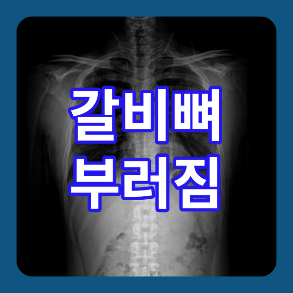  갈비뼈 부러짐 구분하는 방법 총정리!