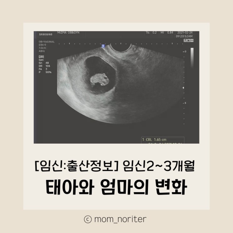 [맘노리터정보_임신(초기)] 임신 초기 5~12주차 (임신 2~3개월) 뱃 속 태아는 어떻게 성장할까요? 엄마가 되어가는 변화과정, 임신 초기 태아와 산모를 위한 건강한 생활법