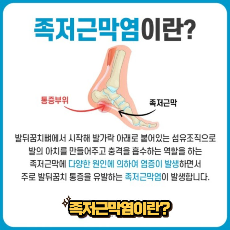 발바닥 통증 족저근막염 원인과 증상 및 치료법