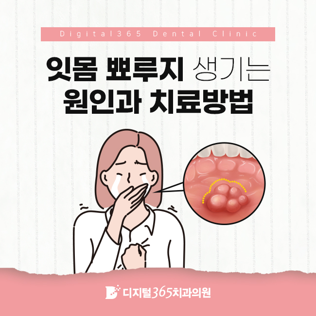  울산치과 잇몸 뾰루지 생기는 원인과 치료방법