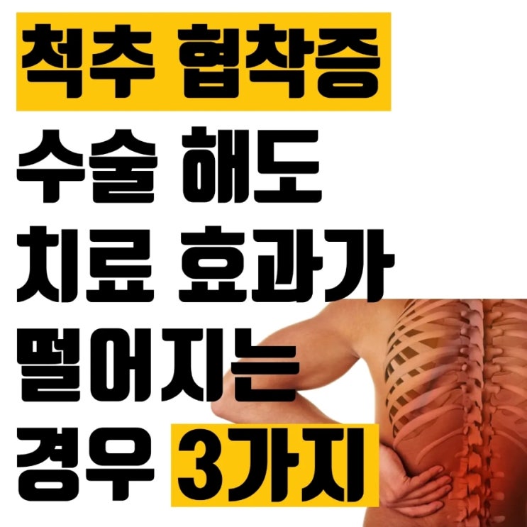  척추 협착증 수술 해도 치료 효과가 떨어지는 경우 3가지