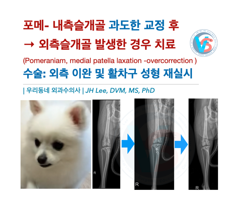  포메: 내측슬개골 과도한 교정 후 외측슬개골 발생한 경우 수술적 치료-외측 이완 및 활차구 성형 재실시(medial patella luxation -overcorrection)