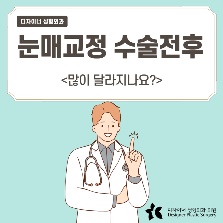  눈매교정수술전후 많이 달라지나요?
