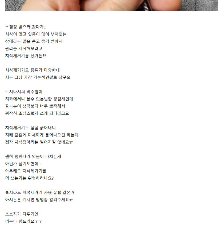  치석 제거기, 셀프 스케일링을 제가 추천드리지 않는 이유 , 강동구 송파구 서울바로치과