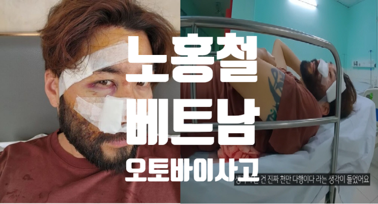  노홍철 베트남 오토바이 사고 응급실행