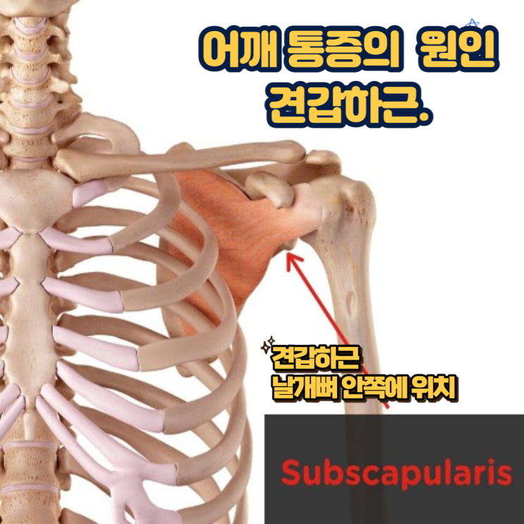  어깨통증 원인 견갑하근 통증 & 스트레칭 & 마시지방법