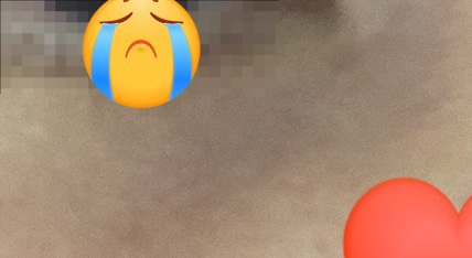  필러는 하는 것보다 제거가 더 어렵다 ㅠㅠㅠ