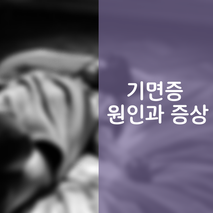 갑작스런 졸음 기면증