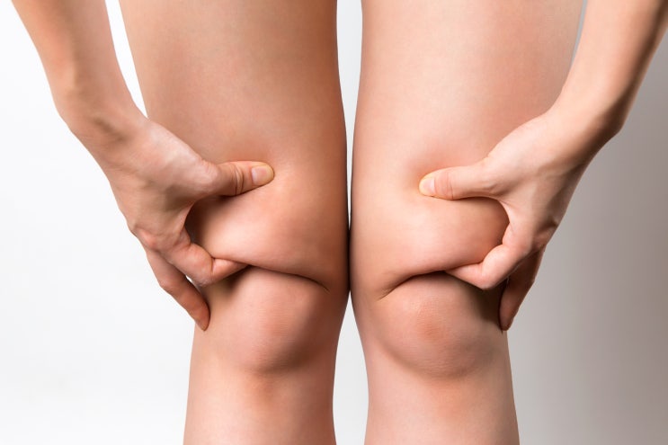  부종 원인부터 알아두면, 발목붓기 빼는 법 쉬워집니다!