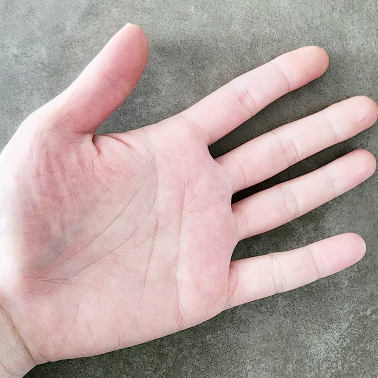  미각다한증 원인 밥먹을때 땀 흘린다면 주목
